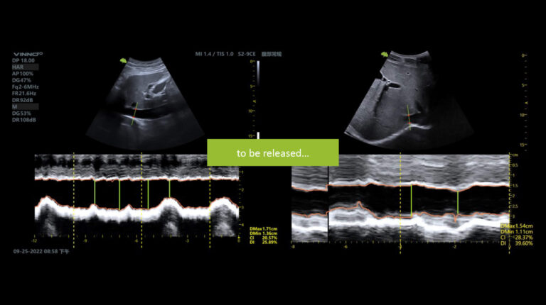 Fkt-Bilder-quer_Auto-IVC1