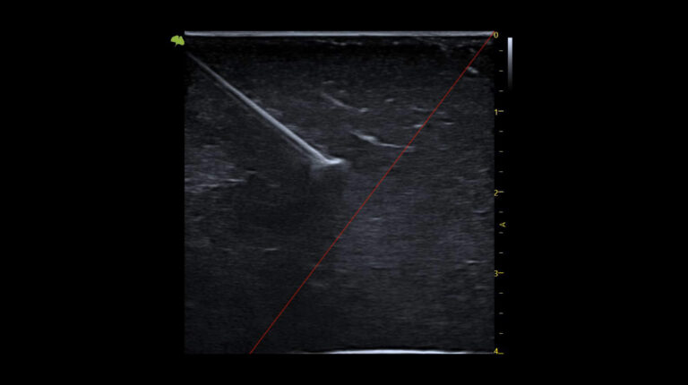 Fkt-Bilder-quer_Auto-Needle-Enh