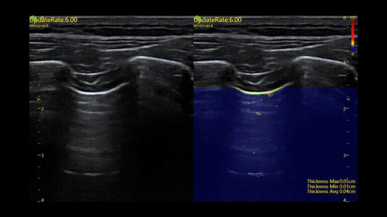 Fkt-Bilder-quer_Auto-Pleural