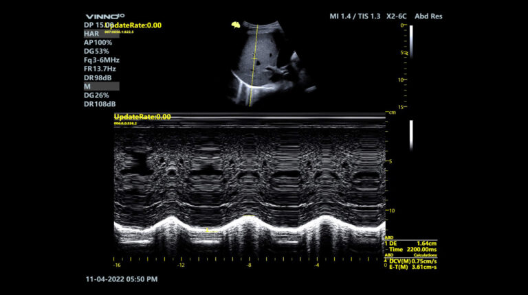 Fkt-Bilder-quer_Diaphragm