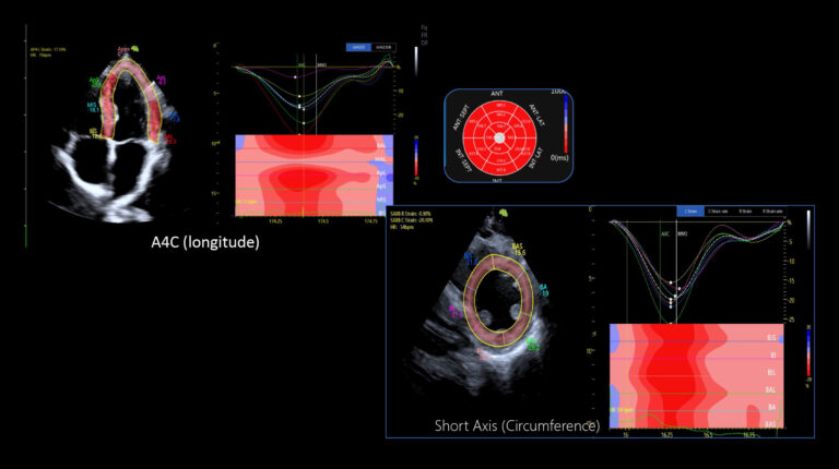 Fkt-Bilder-quer_Strain-Imaging