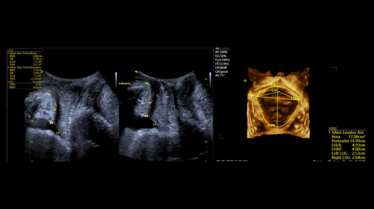 Fkt-Bilder-quer_VAim-Pelvic